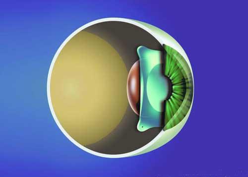 脉络视网膜炎该如何预防