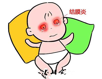 新生宝宝也会得结膜炎？ 新生儿结膜炎如何应对？